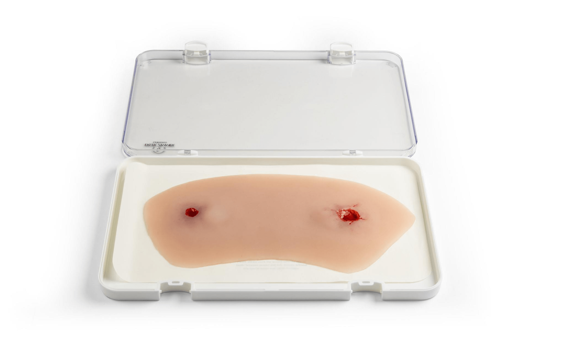 Wundmoulage Schuß Sprunggelenk - Erler - Zimmer